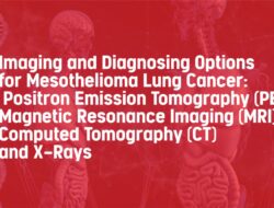 Imaging and Diagnosing Options for Mesothelioma Lung Cancer: Positron Emission Tomography (PET), Magnetic Resonance Imaging (MRI), Computed Tomography (CT) and X-Rays