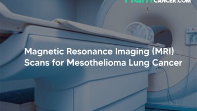 Magnetic Resonance Imaging (MRI) Scans for Mesothelioma Lung Cancer