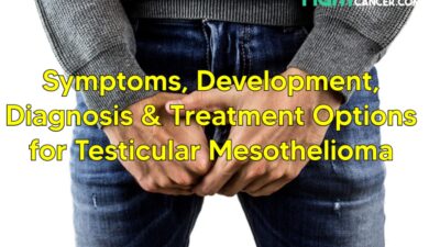 testicular mesothelioma